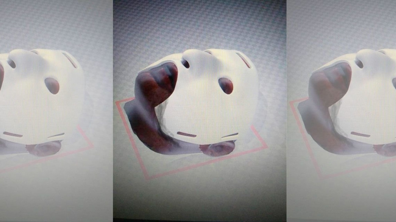 Cirujanos argentinos crearon máscara 3D para reconstrucción facial en casos de quemaduras